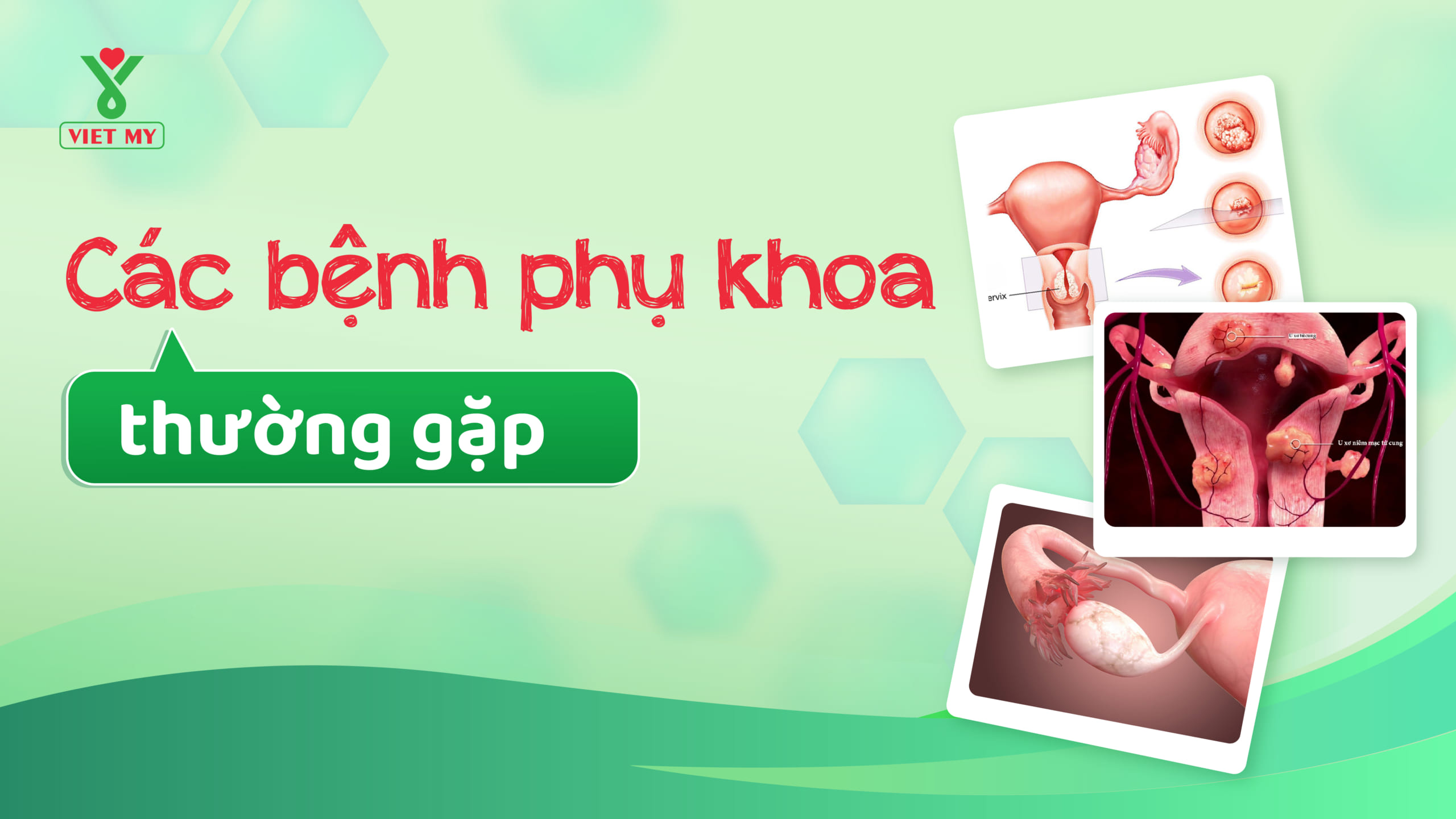 Các bệnh phụ khoa thường gặp